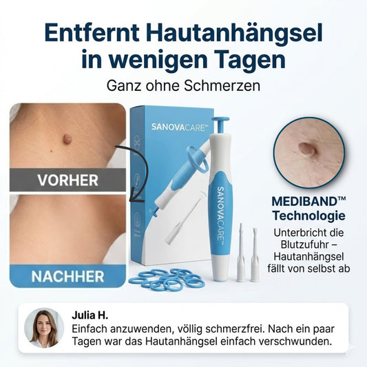 SANOVACARE™ – Sanfte, schmerzfreie Entfernung von Hautanhängseln zuhause